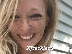Xfreckledx